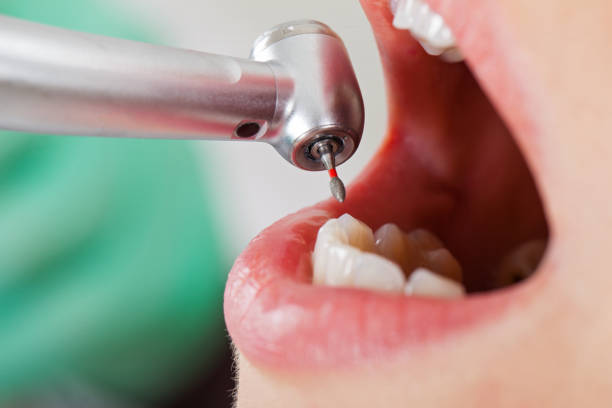 Best Walk-In Emergency Dentist in Newkirk, OK